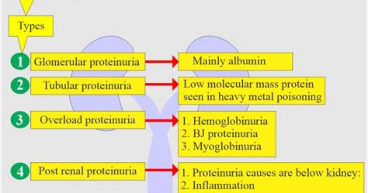 Which Causes Massive Proteinuria?
