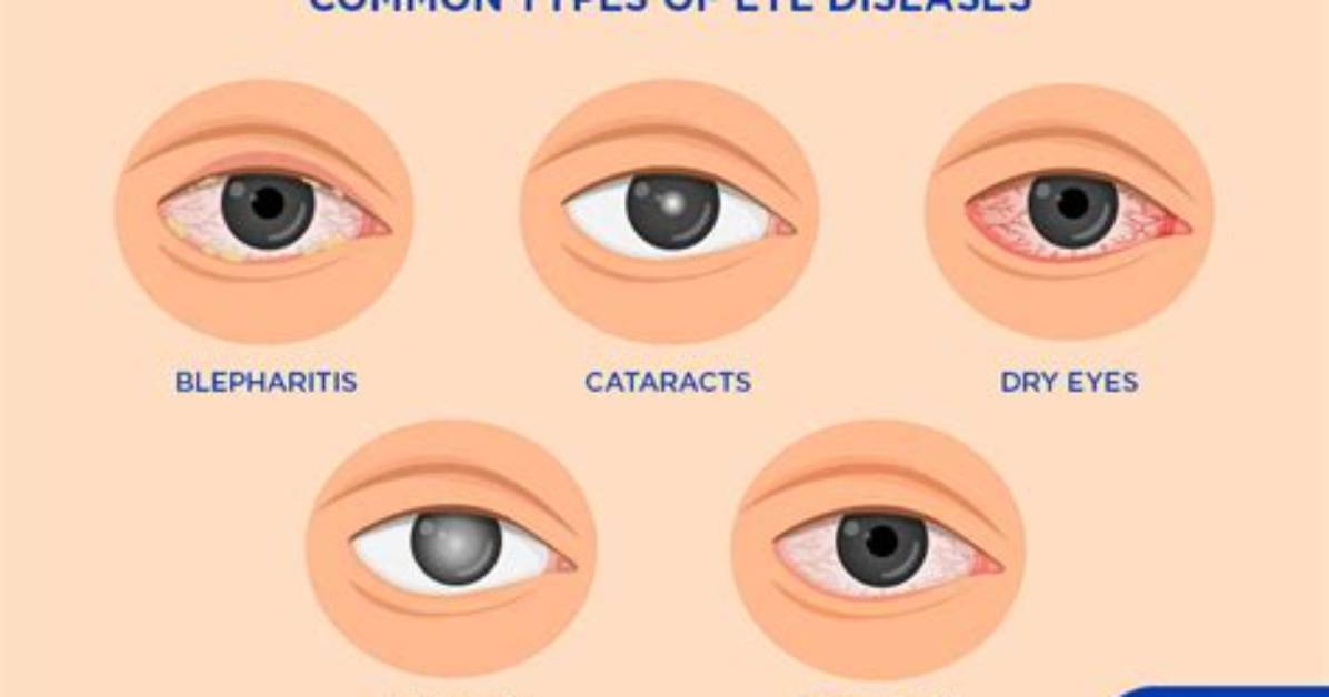 Which Diseases or Disorders Affect the Eye