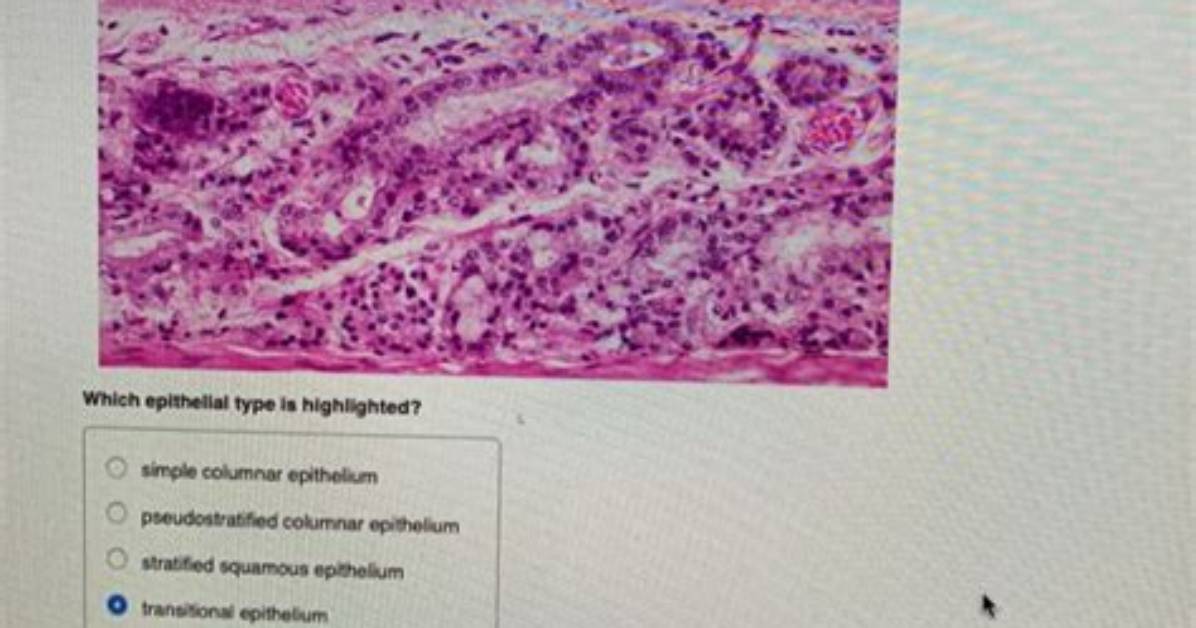 Which Epithelial Type Is Highlighted?