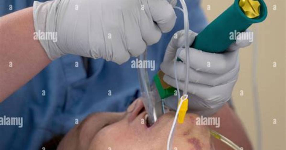 Which Hand Do You Intubate with?