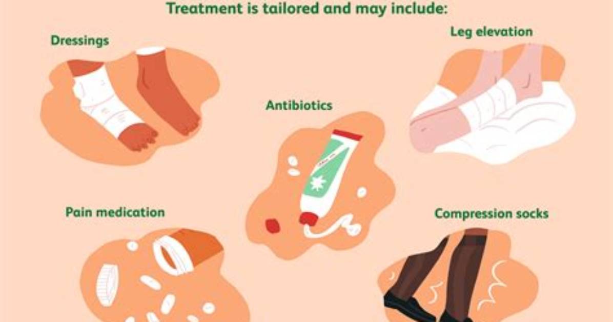 Which Helps Prevent Decubitus Ulcers?