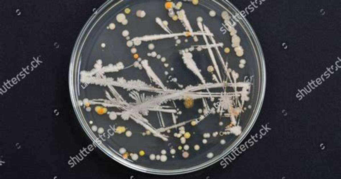 Which Is a Bacterial Colony?