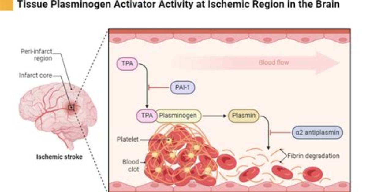 Which Is Tissue Plasminogen Activator?