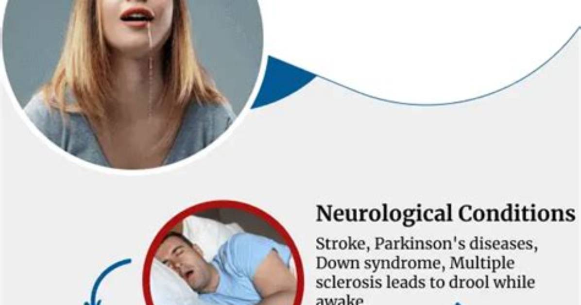 Which Medications Cause Drooling?
