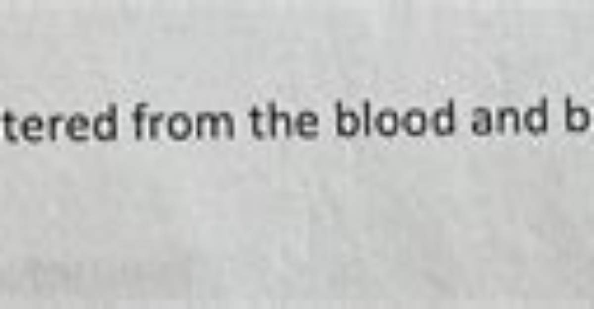 Which Molecules Cannot Be Filtered?