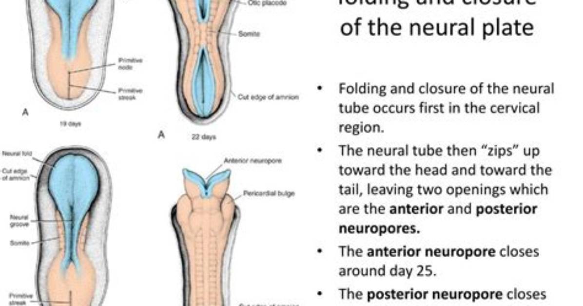 Which Neuropore Closes First?