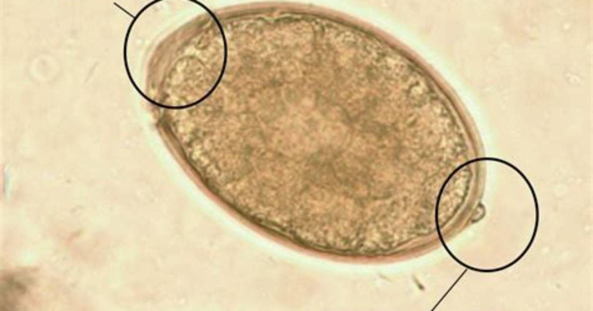 Which Parasite Eggs Have Operculum?