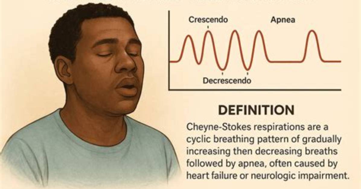 Which Statement Describes Cheyne-Stokes Respirations?