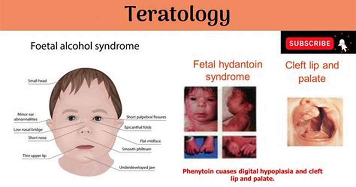 Which Teratogen Causes Deafness?
