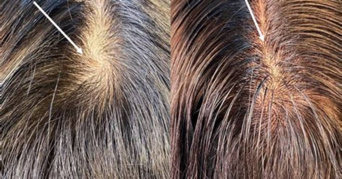 Which Way Does My Cowlick Go?