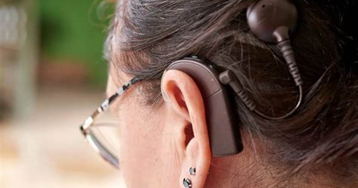 Who Are Cochlear Implants for?