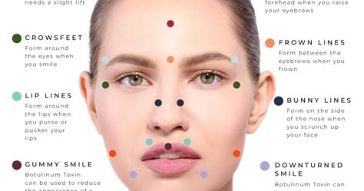 Who Can Administer Botox?