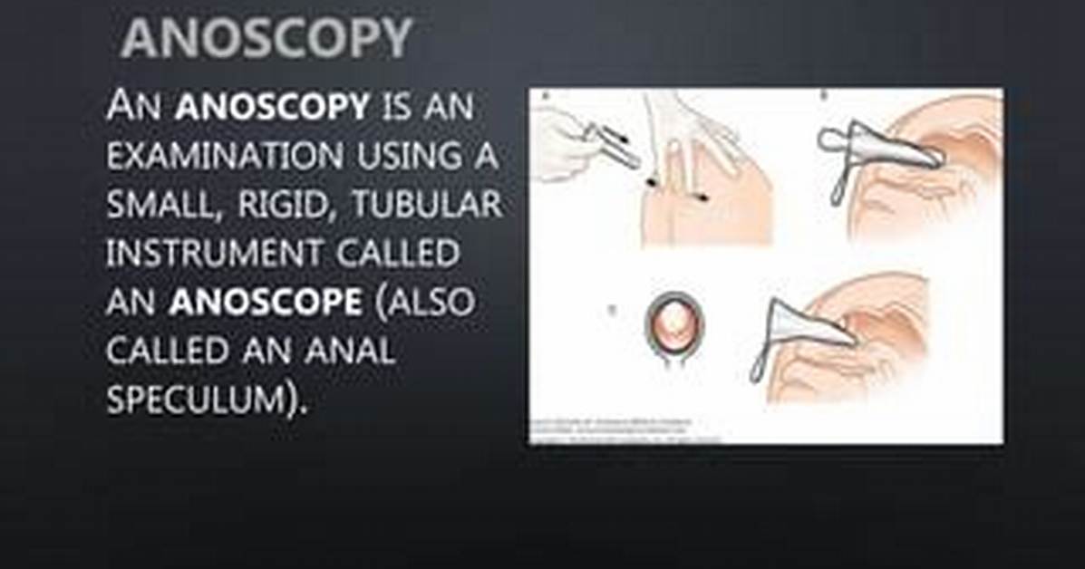 Who Can Perform Anoscopy?
