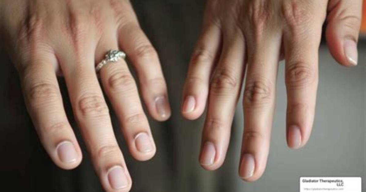 Who Do Fingernails Grow?
