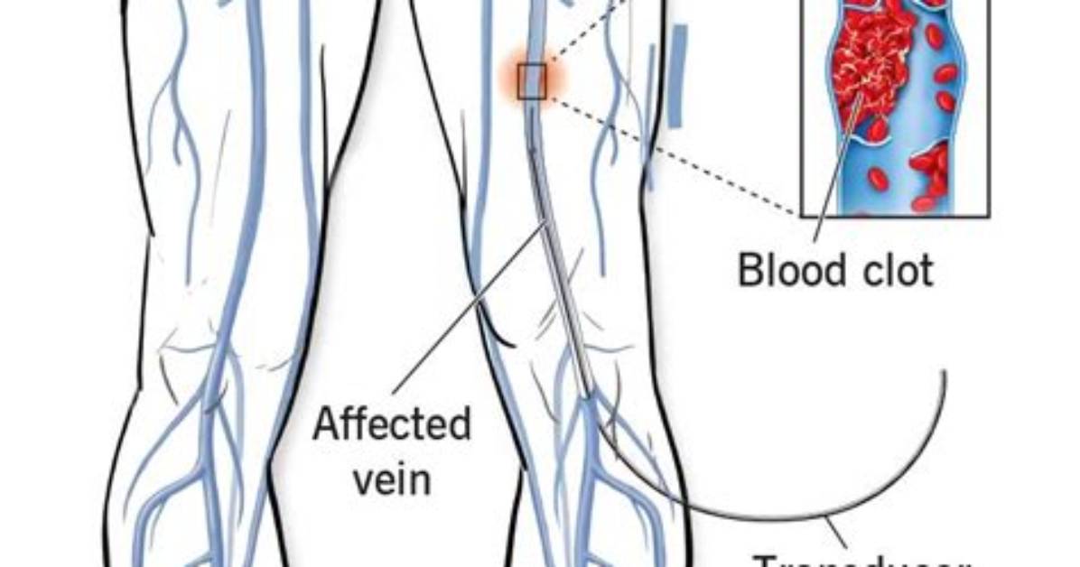 Who Does a Venogram?