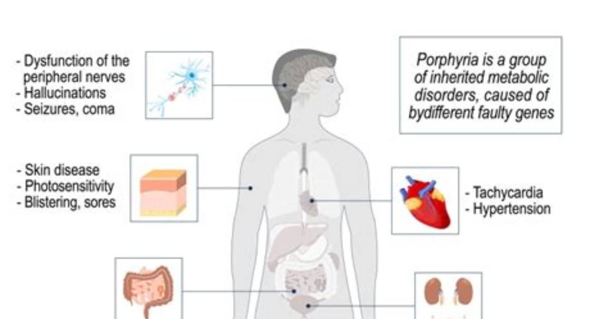 Who Does Porphyria Mostly Affect?