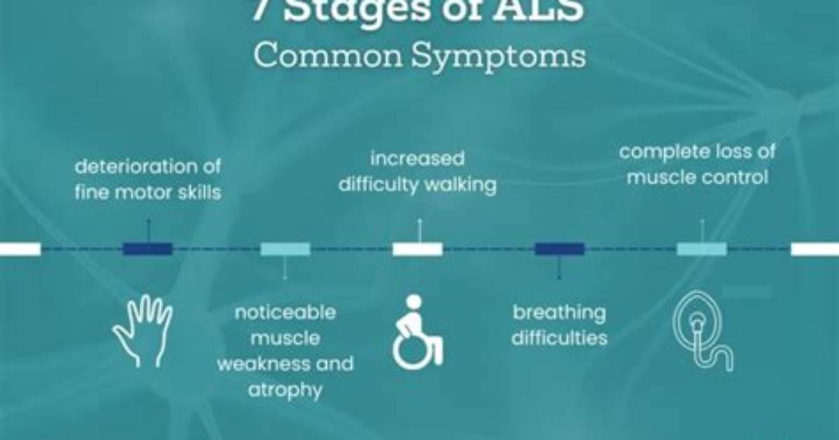 Who First Got Als