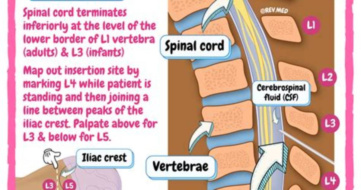 Who Performs Lumbar Punctures?