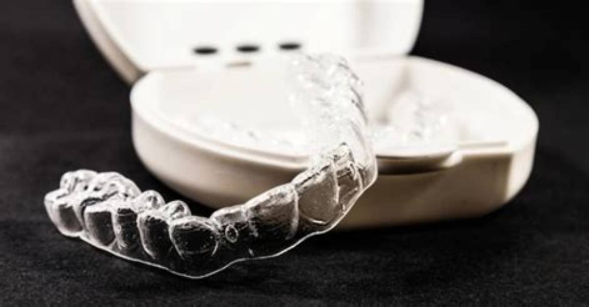 Why Are Aligners So Expensive?