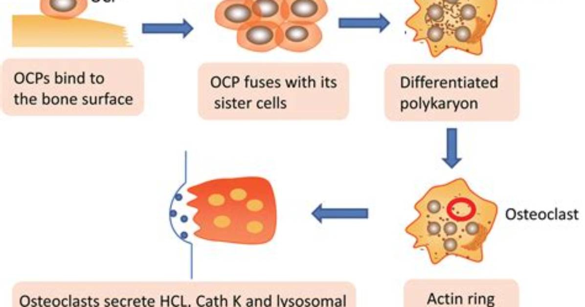 Why Are Osteoclasts Multinucleated?