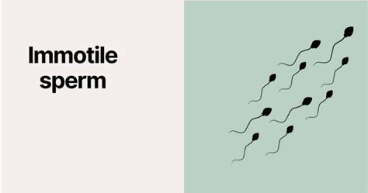 Why Are Sperm Immotile?