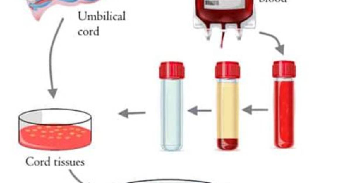 Why Are Stem Cells Collected