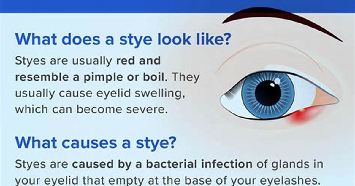 Why Are Styes Contagious?