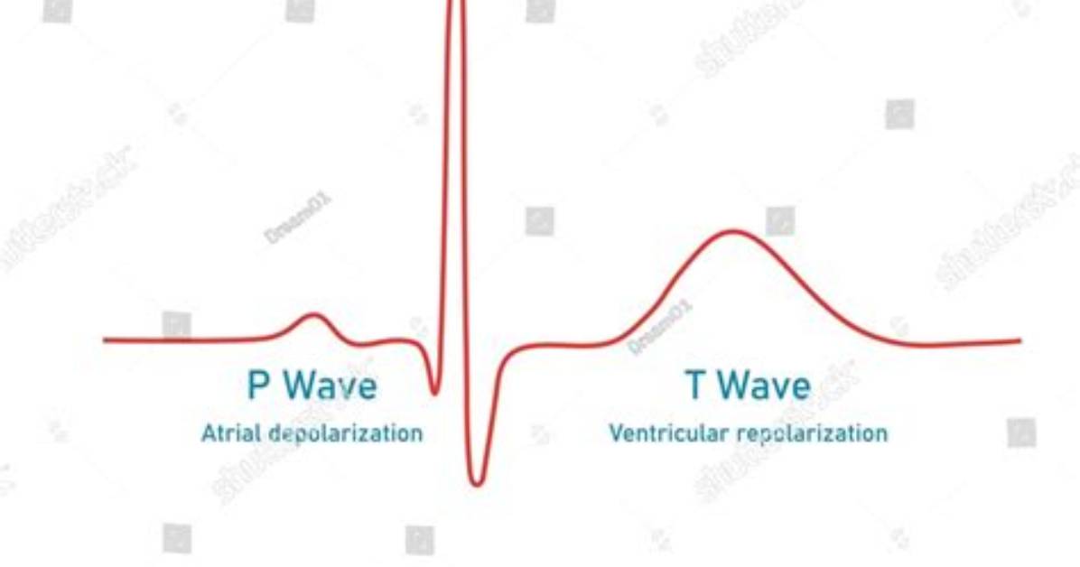 Why Atrial Repolarization Not Seen on Ecg?