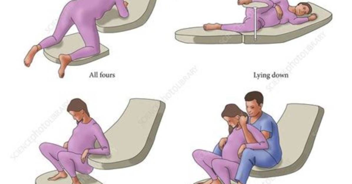 Why Birthing on Your Back Is Bad?