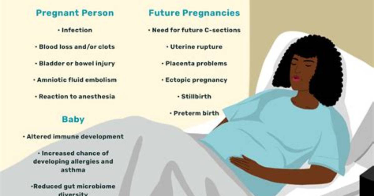 Why C-Section Is Not Good