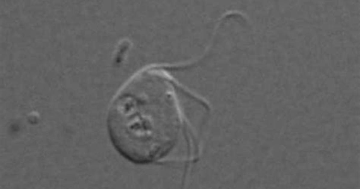Why Can Monocercomonoides Survive Without Mitochondria?