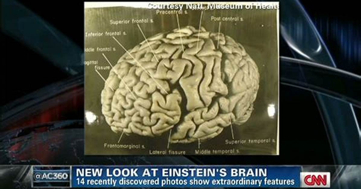 Why Did Einstein Cut His Brain?