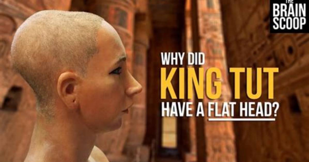 Why Did King Tut Have a Flat Head