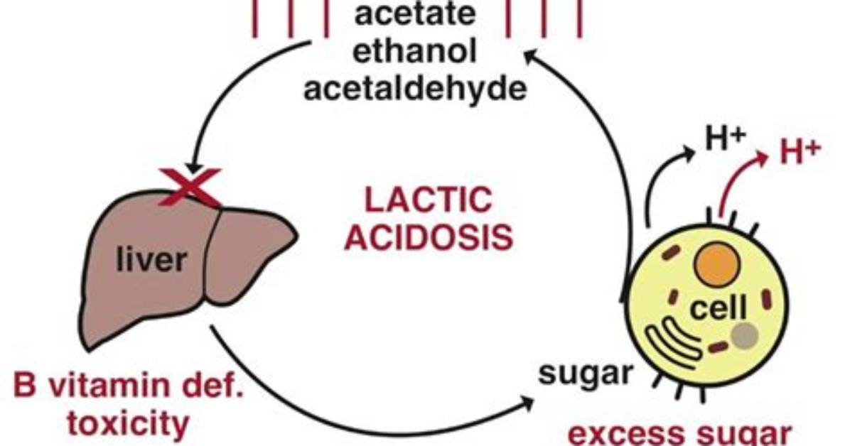 Why Do Biguanides Cause Lactic Acidosis?