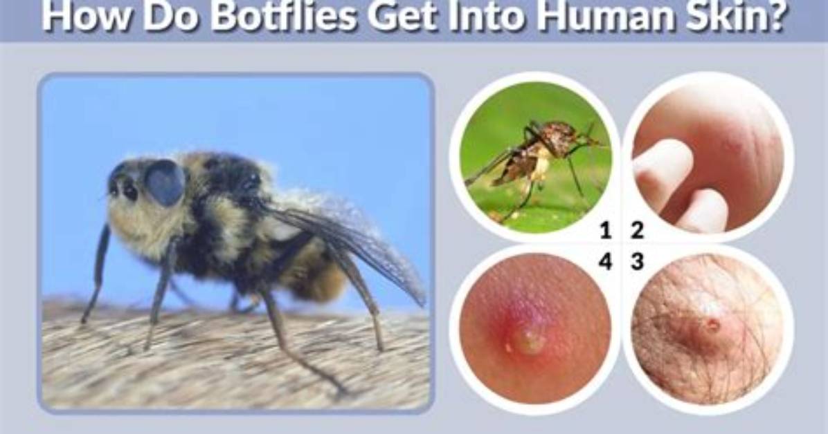 Why Do Botflies Get in Humans?