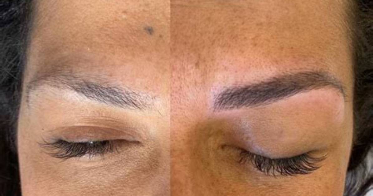 Why Do Eyebrows Disappear After Microblading?