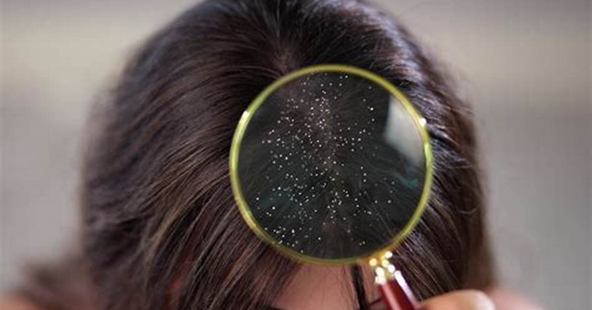 Why Do Hair Itch When It Grows?