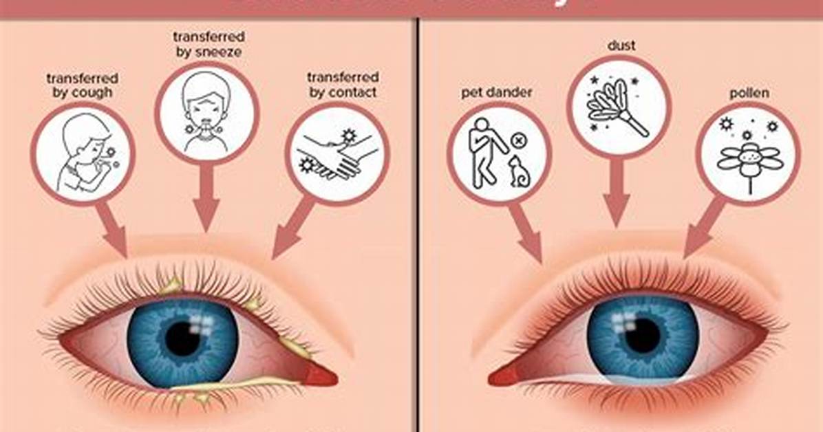 Why Do I Always Get Pink Eye?