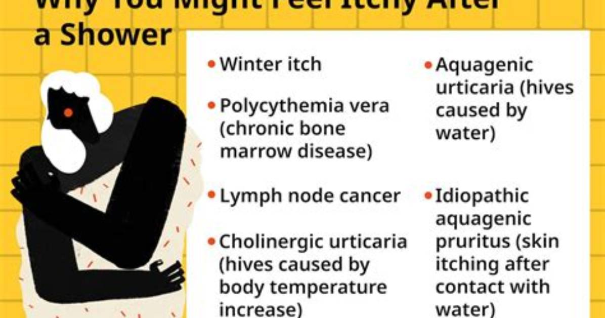 Why Do I Get Itchy After a Hot Shower?