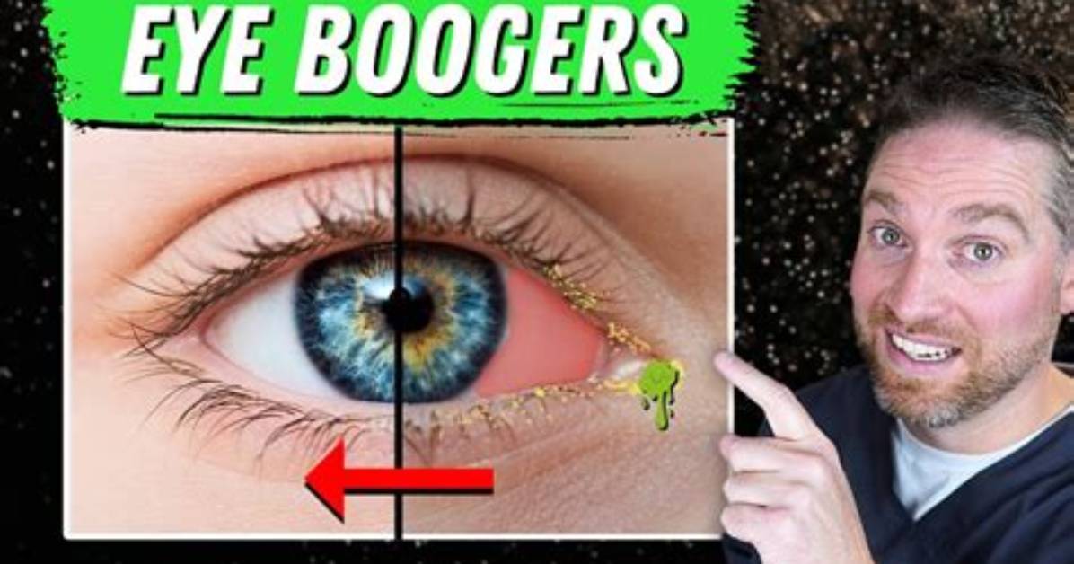 Why Do I Get So Many Boogers?