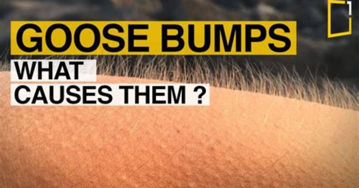 Why Do I Have Gooseflesh?