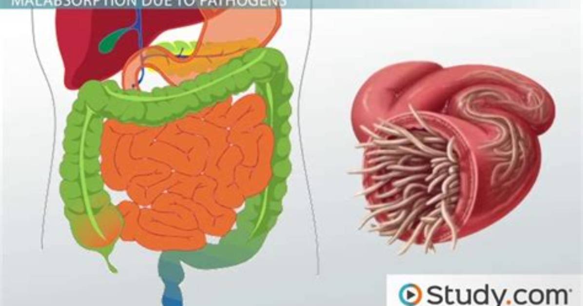 Why Do I Have Maldigestion?