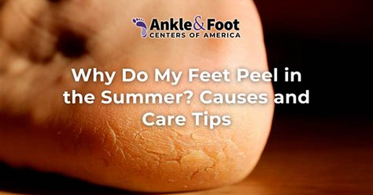 Why Do I Keep Scuffing My Feet?