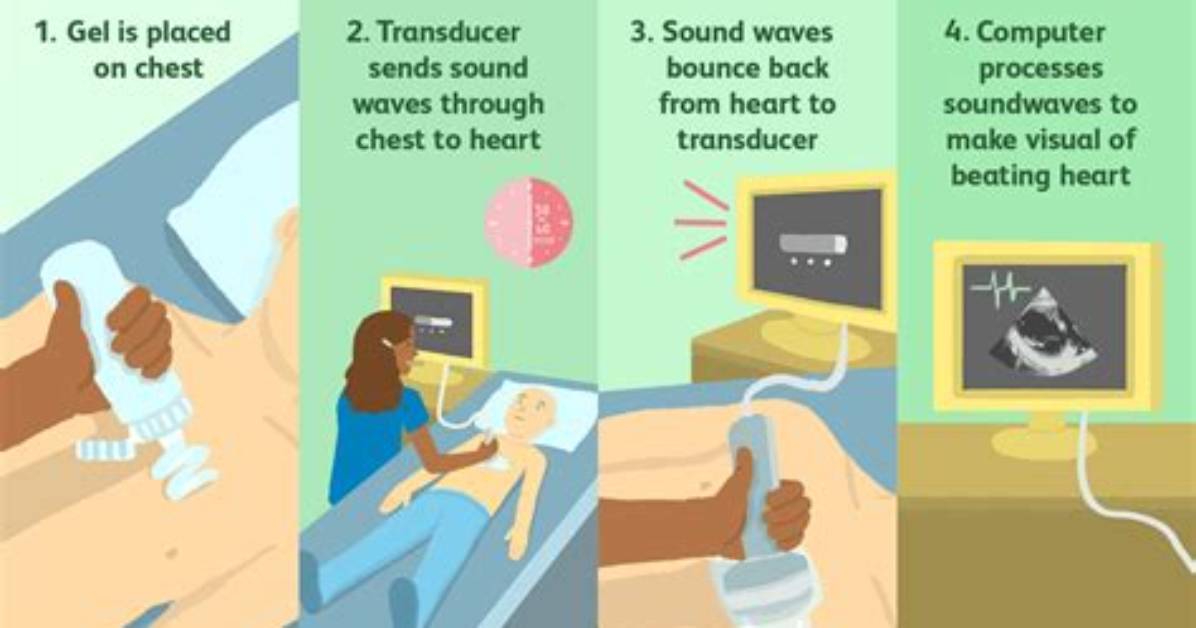 Why Do I Need a Transthoracic Echocardiogram?