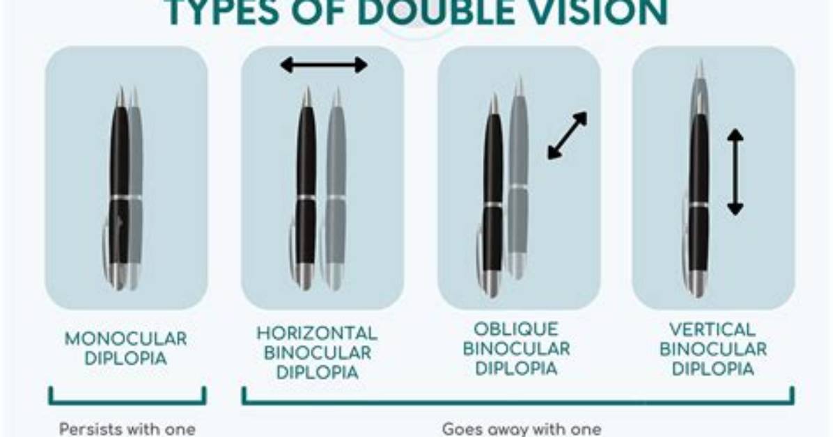 Why Do I See Double?