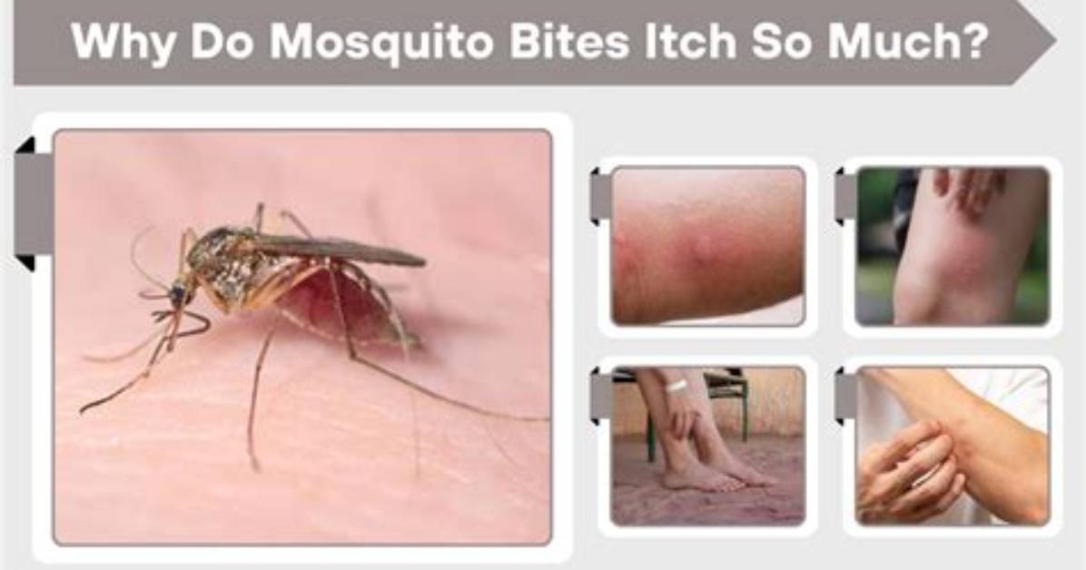 Why Do Midge Bites Itch So Much?