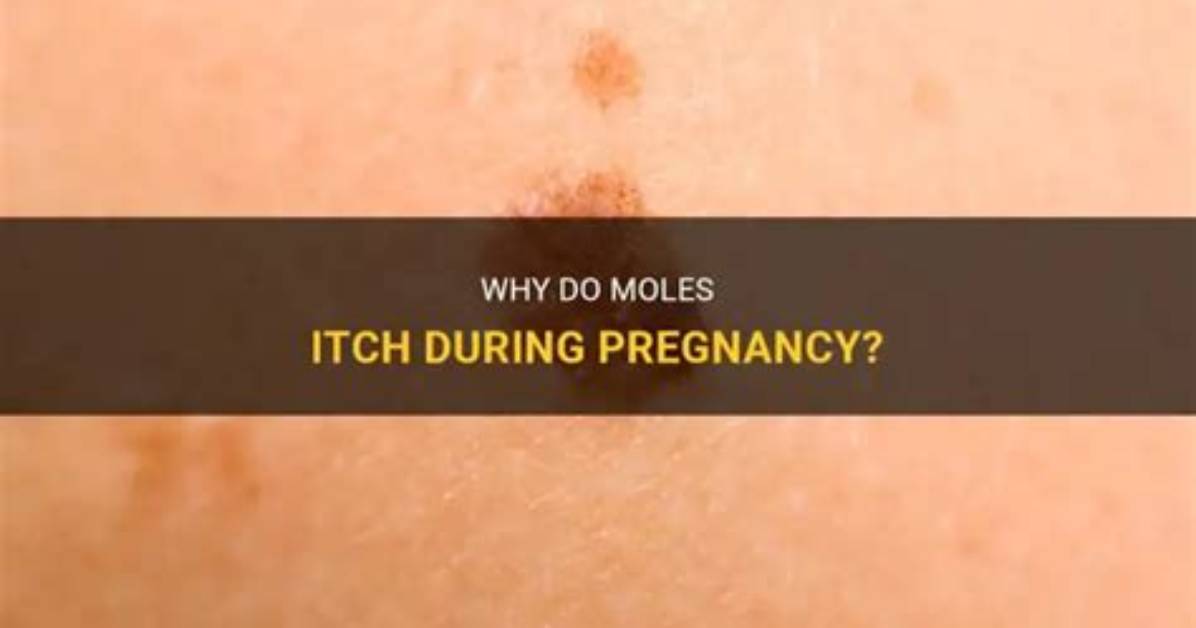 Why Do Moles Itch