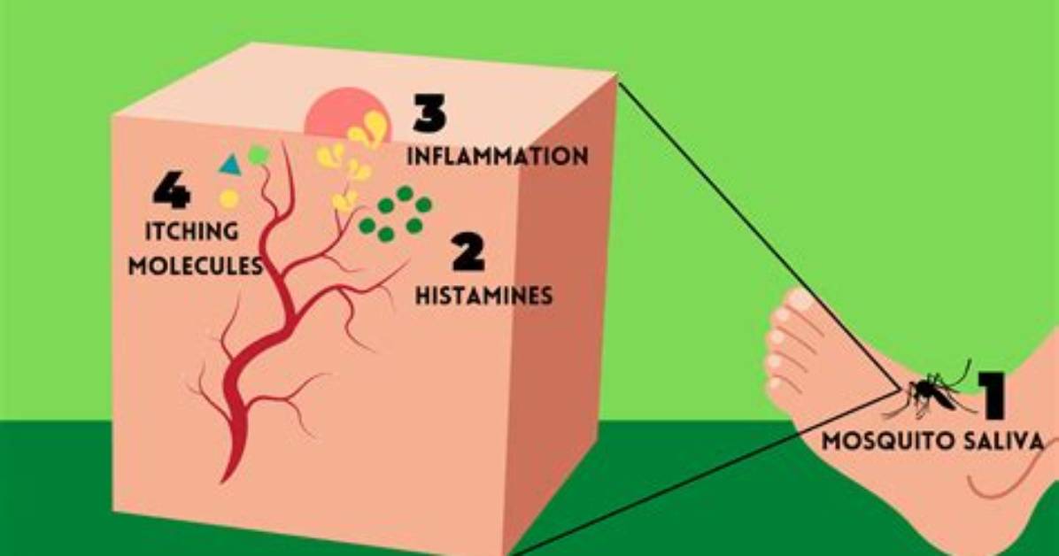 Why Do Mosquito Bites Itch?
