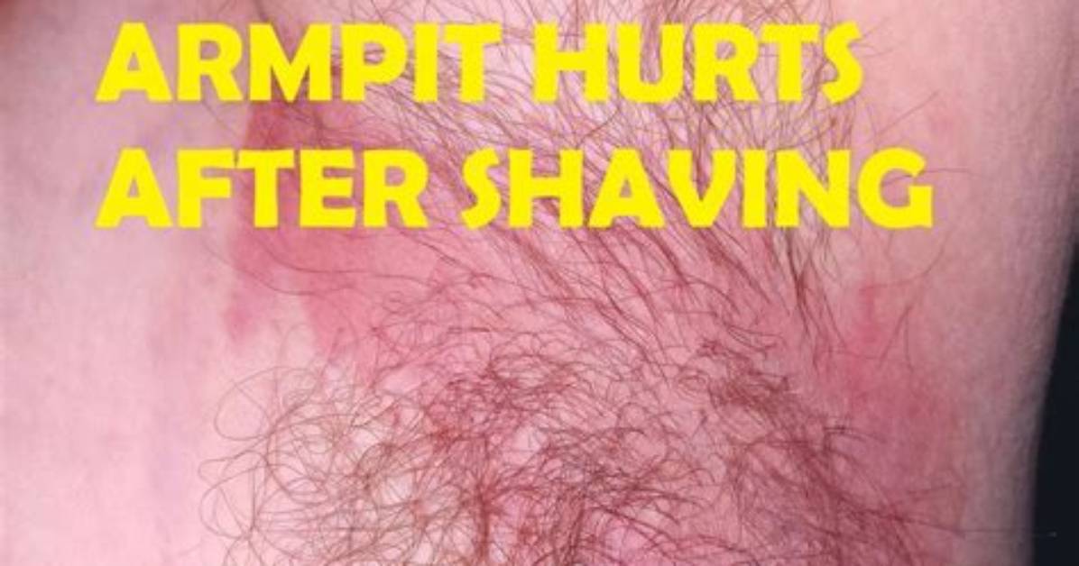 Why Do My Armpits Burn?