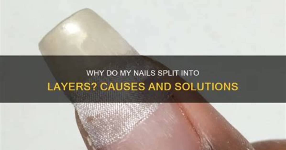 Why Do My Nails Split Lengthwise?